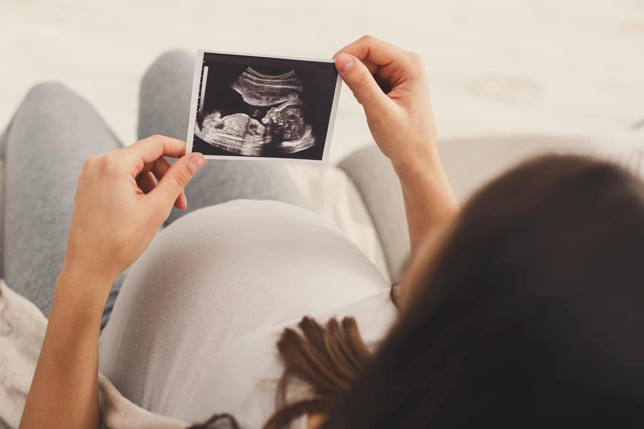 Decorative image of a pregnant person looking at a scan photograph