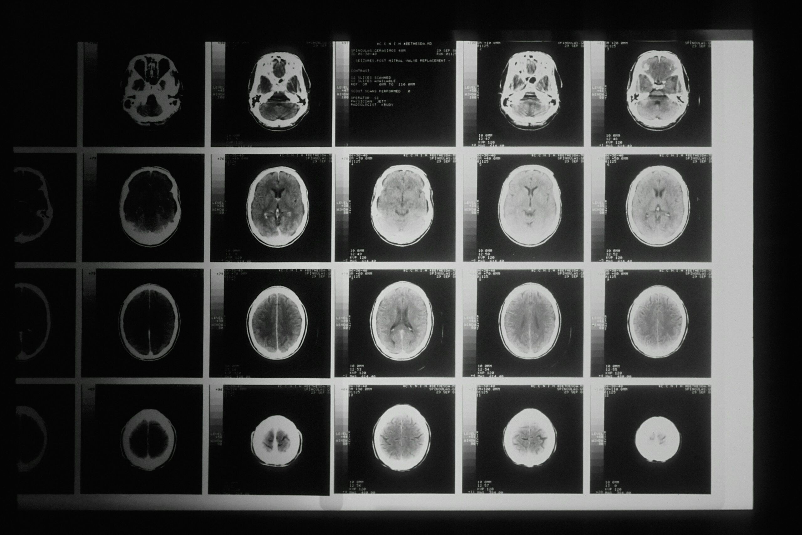 A scan image showing multiple x-rays of the brain.