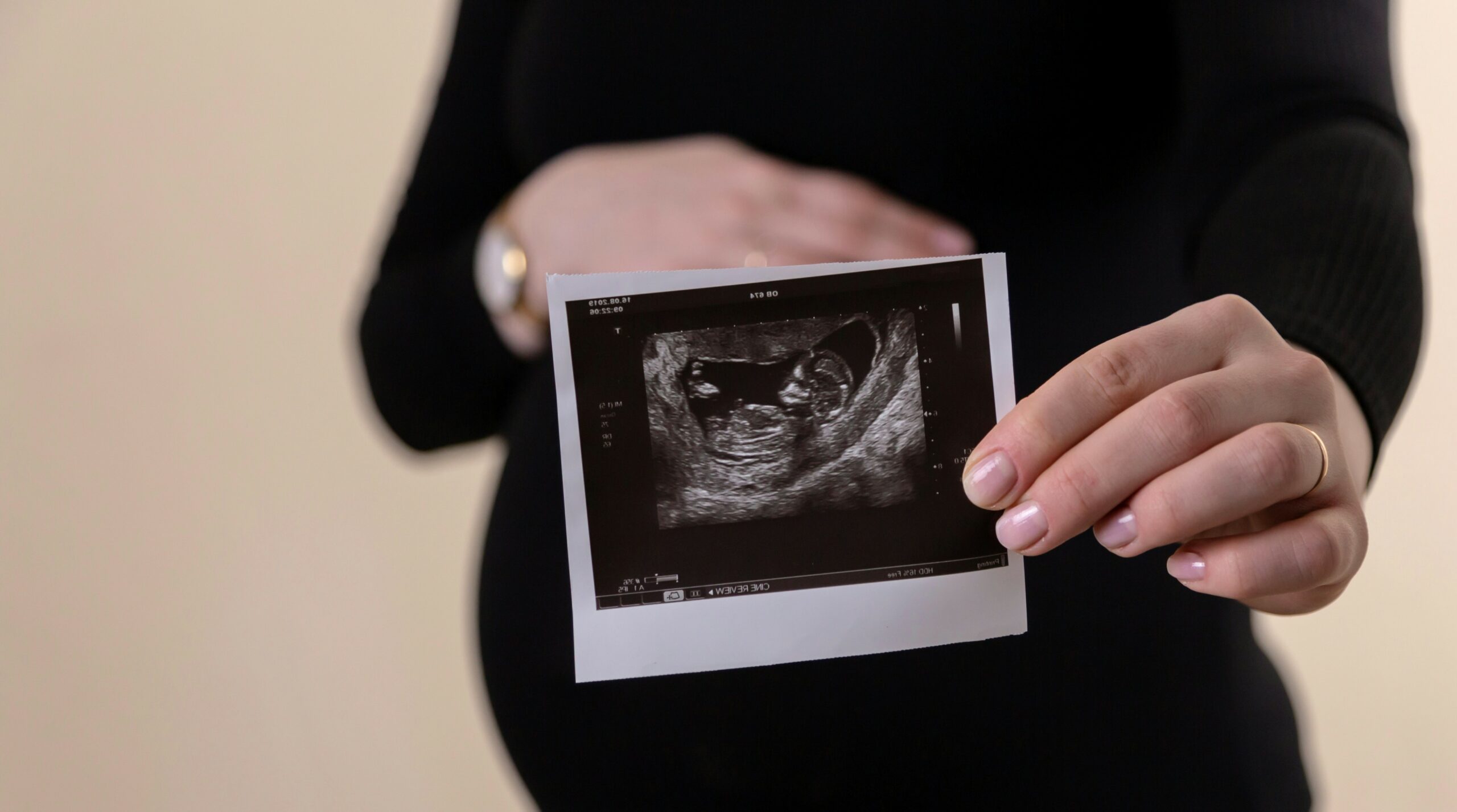 Pregnant person on a side view holding a scan picture close to the camera in focus with the background blurred showing a silhouette of the pregnant bump